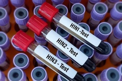بريطانيا ترصد أول حالة بشرية مصابة بأنفلونزا مشابهة لفيروس يصيب الخنازير